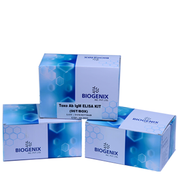 Toxo IgM