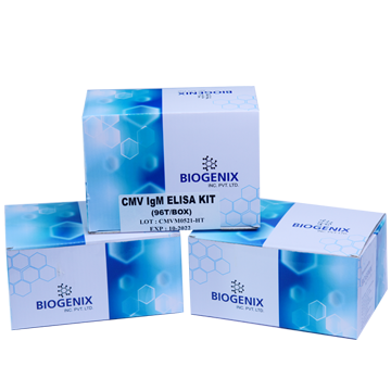 CMV IgM